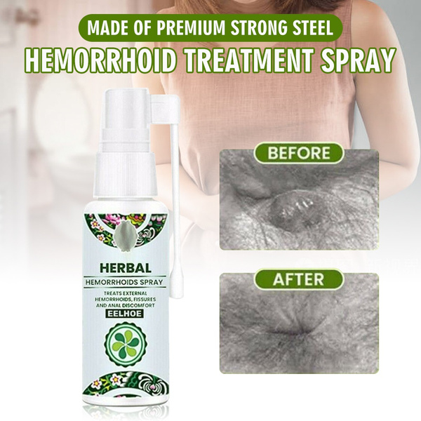 30ml Hemorrhoid Treatment Spray No Stimulation Natural Essence