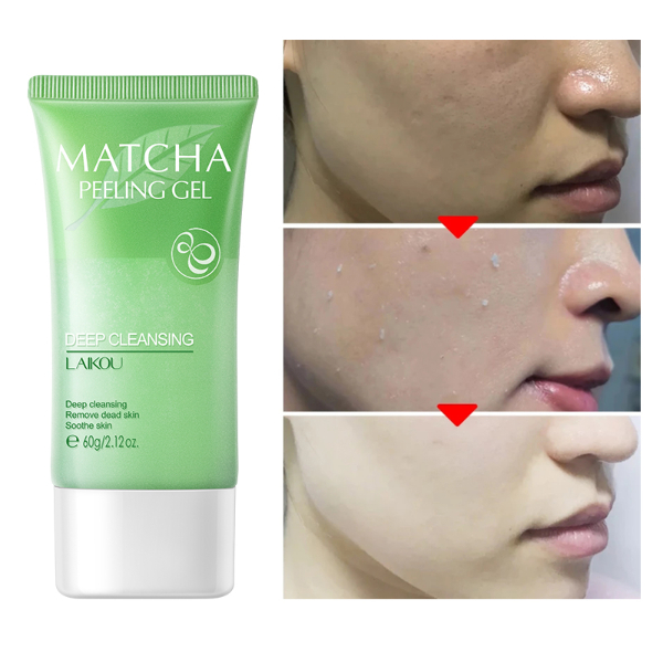 Matcha Peeling Gel 60g Gentle Oil Control Body Face Scrub Cleansing Pores Treatment Acne Remove Skin Care