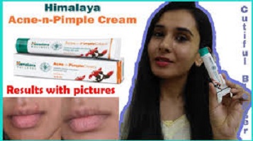 Himalaya Skin Care Pimple Acne Clear Cream