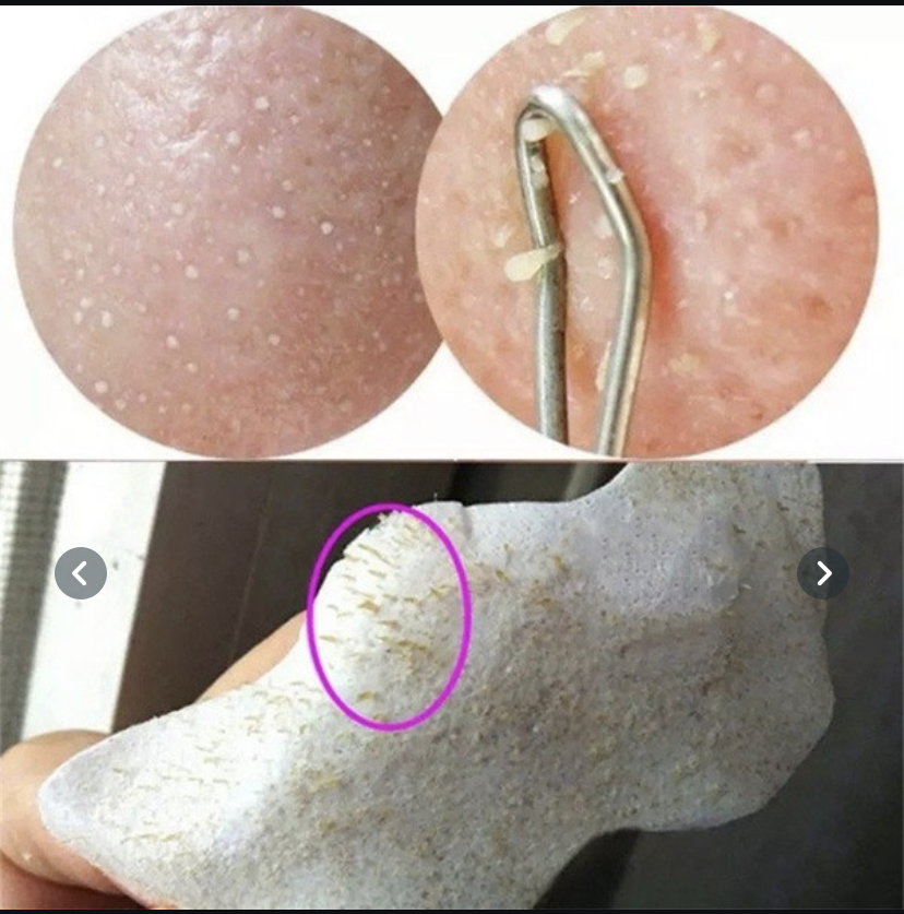 60Pcs Deep Cleansing Nose Strips Blackhead Remover Nasal Spot Facial Dot Sticker Sheet Nose Mask