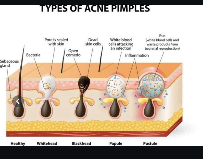 60Pcs Deep Cleansing Nose Strips Blackhead Remover Nasal Spot Facial Dot Sticker Sheet Nose Mask