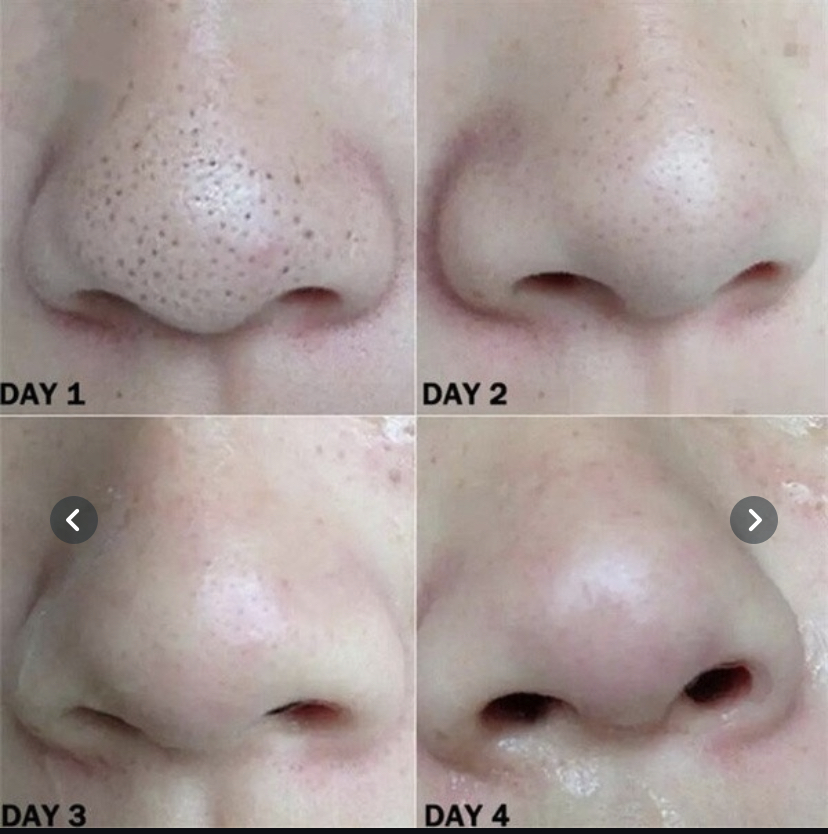 60Pcs Deep Cleansing Nose Strips Blackhead Remover Nasal Spot Facial Dot Sticker Sheet Nose Mask