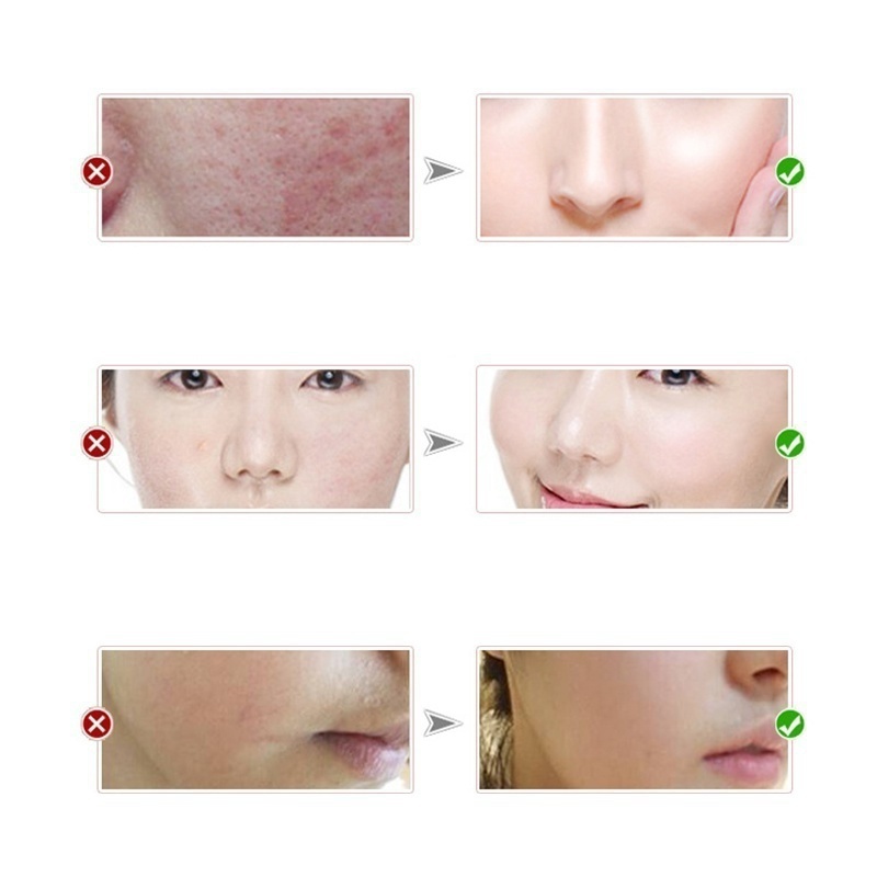 The latest vitamins, whitening cream, repair and fade freckles, remove dark spots, melanin remover