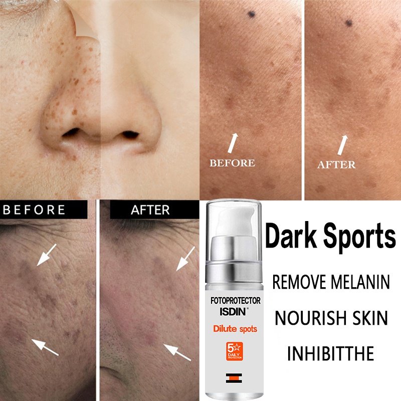 The latest vitamins, whitening cream, repair and fade freckles, remove dark spots, melanin remover