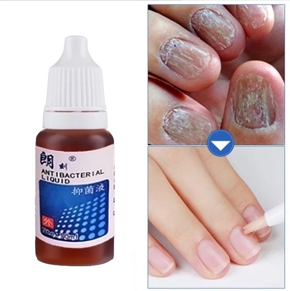Chinese Medicine Herbs Toe Nail Fungus Treatment Massage Anti Fungal Nail Infection Nail Care