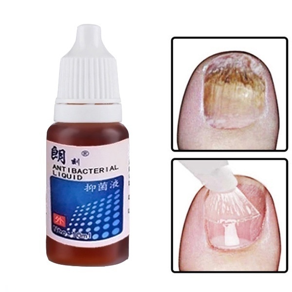 Chinese Medicine Herbs Toe Nail Fungus Treatment Massage Anti Fungal Nail Infection Nail Care