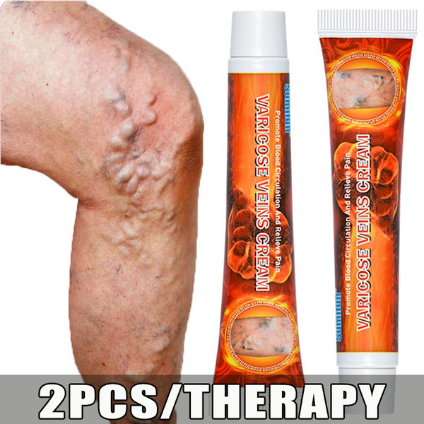 20g Varicose Veins Ointmnet Vasculitis Phlebitis Spider Cream Varicosity Angiitis Removal Herbal Medical Plaster