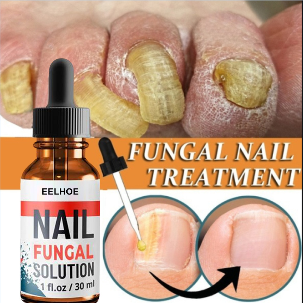 Nail repair liquid hand and foot grey nail care repair grey nail liquid thickening soft nail