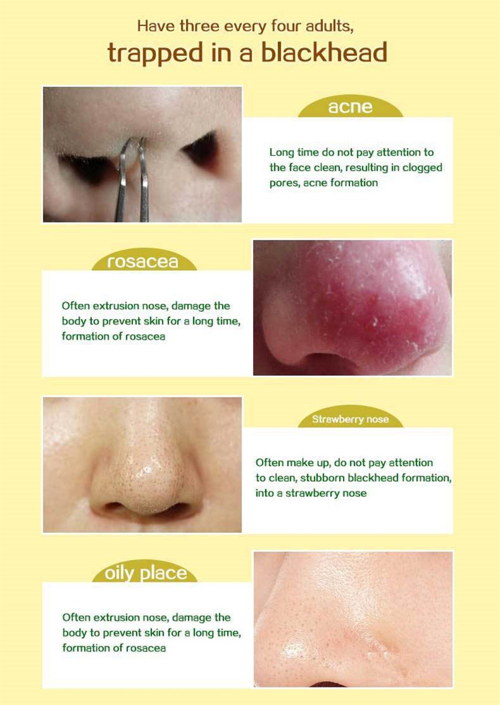 Aichun Beauty Caviar Purifying Peel Off Blackhead Remover Deep Cleansing Mask-120ml