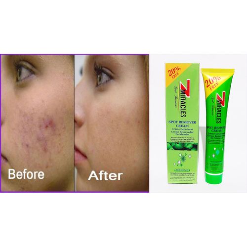 Miracle 7 Miracles Spot Remover Cream BSC Advanced French Formula
