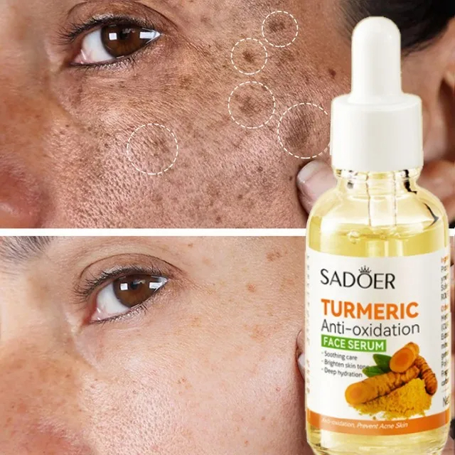 Best Price For Turmeric Face Serum Whitening Dark Spot Remover Acne