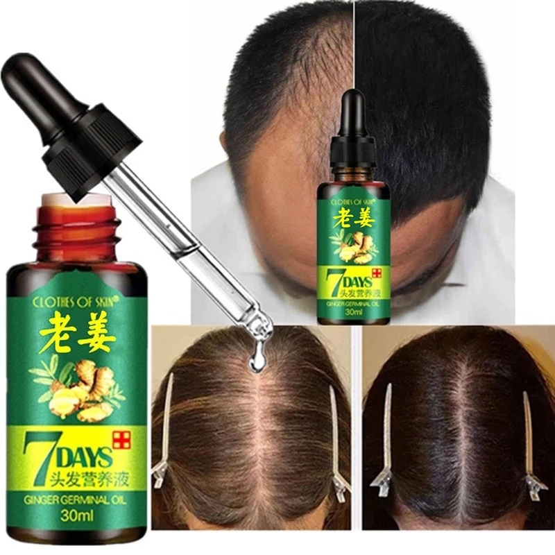 30MLGinger Hair Growth Serum Essence Liquid Prevent Hair Loss Repair Damaged Hair Natural Hair Care Ginger Germinal Oil