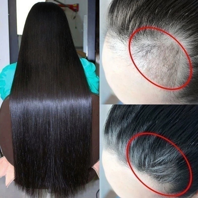 30MLGinger Hair Growth Serum Essence Liquid Prevent Hair Loss Repair Damaged Hair Natural Hair Care Ginger Germinal Oil