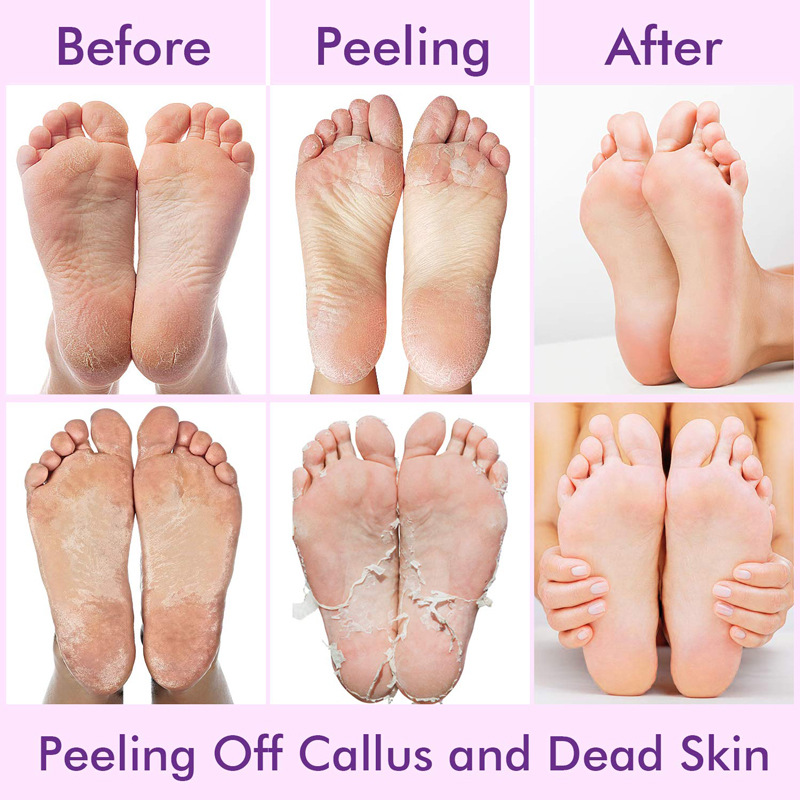 Aloe Vera Foot Peeling Mask Exfoliating Heels Calluses Remove Foot Patches Dead Skin Remover Pedicure Socks Foot Care Tool Foot Spa1Pair