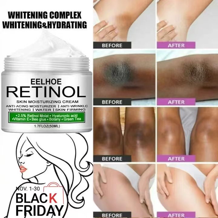 Body Whitening Cream Underarm Knee Buttocks Private Bleach Remove Melanin Pigmentation Improve Dull Nourish Brighten Skin Care