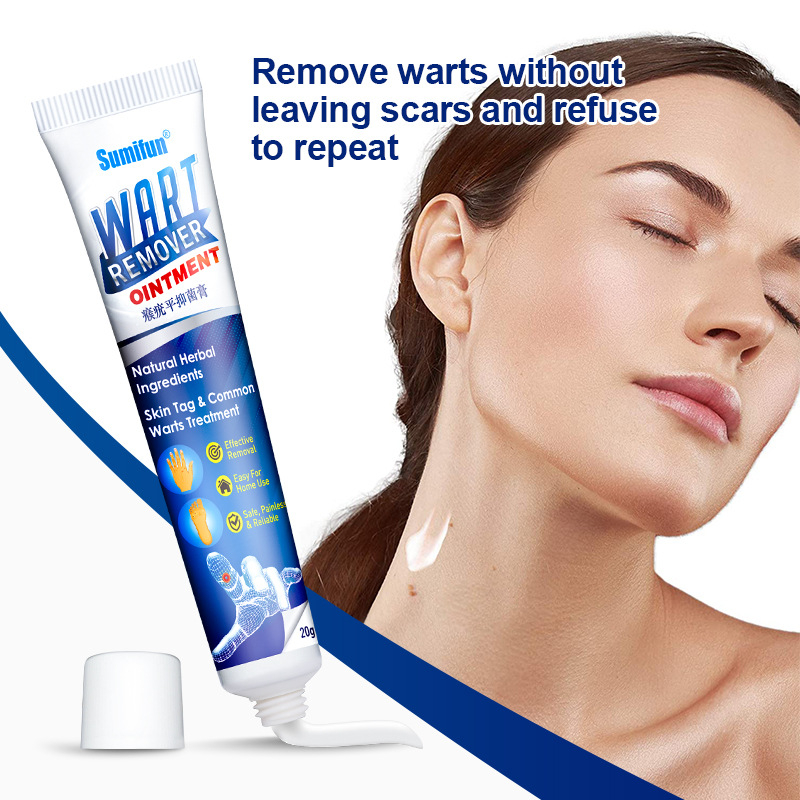 Warts Remover Cream Wart Treatment Cream Skin Tag Remover Foot Corn Antibacterial Warts Cream