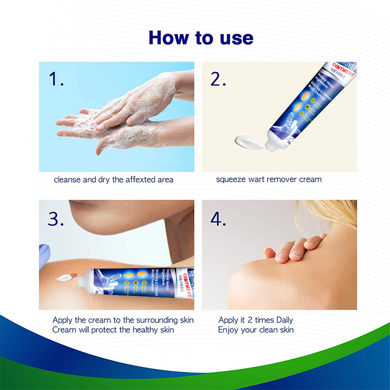 Warts Remover Cream Wart Treatment Cream Skin Tag Remover Foot Corn Antibacterial Warts Cream