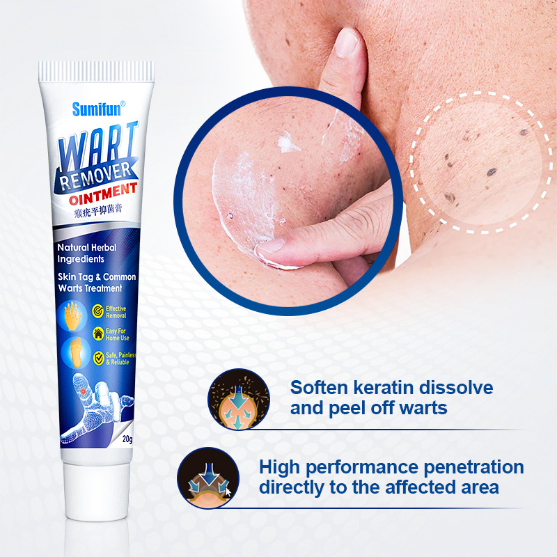 Warts Remover Cream Wart Treatment Cream Skin Tag Remover Foot Corn Antibacterial Warts Cream
