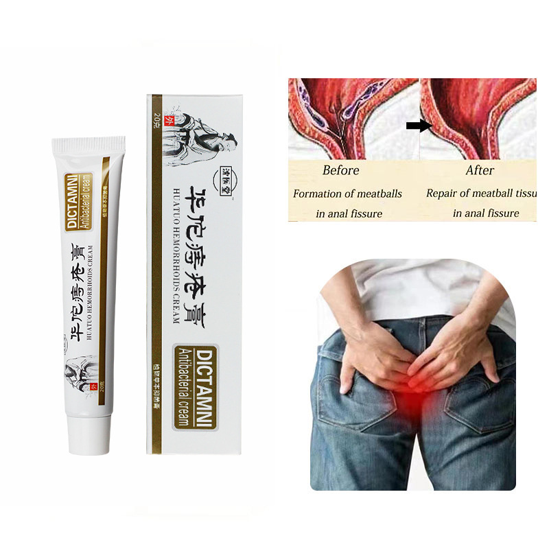 hemorrhoids Cream buttocks care hemorrhoids gel mixed inside and outside the male and female hemorrhoids Cream to remove hemorrhoids ointment