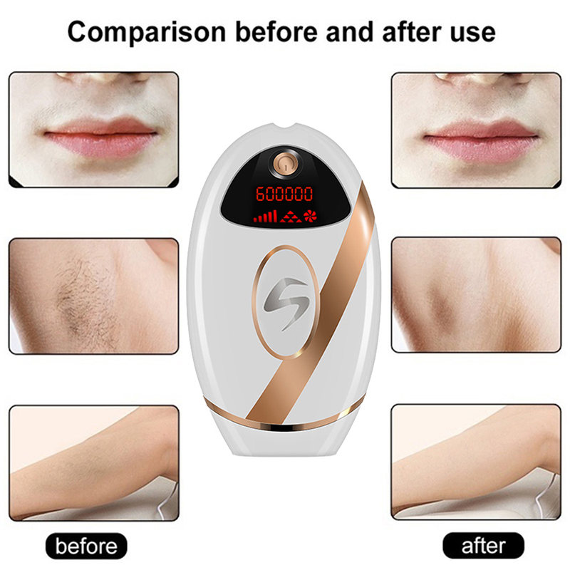 Laser Epilator Permanent Photoepilator Hair Removal Painless Electric Epilator Ladies Whole Body Hair Trimmer Depilador