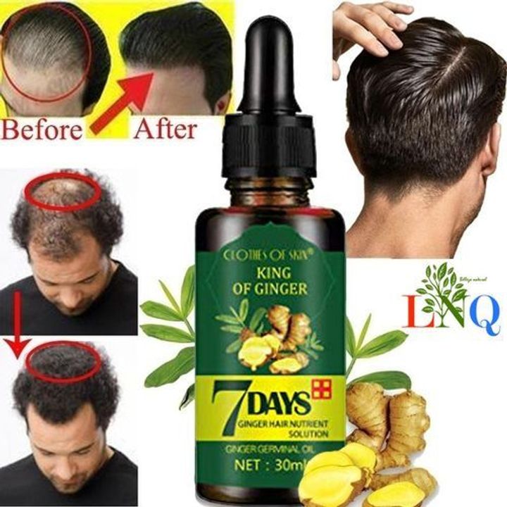 Hair Growth Oil Prevent Hair Loss Treatment