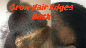 Virgin  Hair Fertilizer Hair Growth Anti-Dandruff Cream edges growth oil