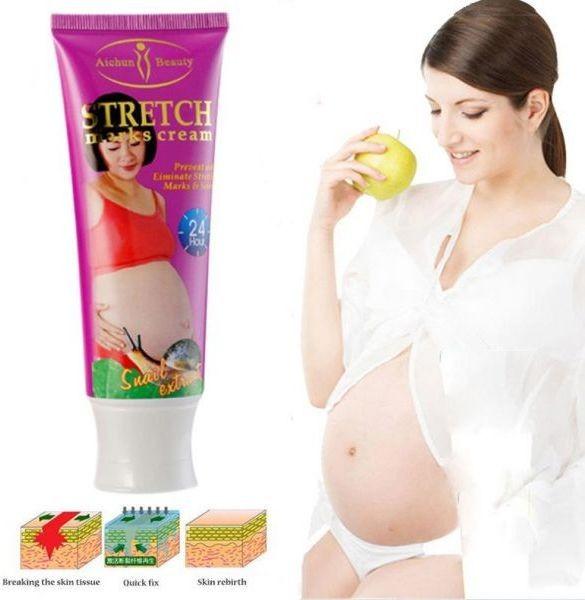 Aichun Beauty Stretch Marks Cream