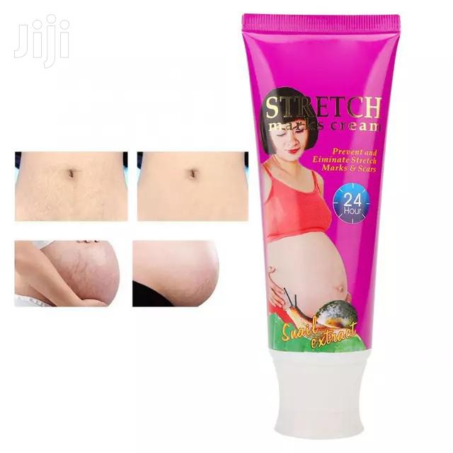 Aichun Beauty Stretch Marks Cream