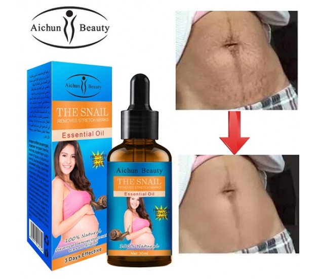 Aichun Beauty Natural Snail Removes Pregnancy Stretch Marks Essential Oil