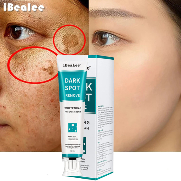 Whitening Freckles Cream Remove Melasma Dark Spots Lighten Melanin Melasma Remover Moisturizing Makeup