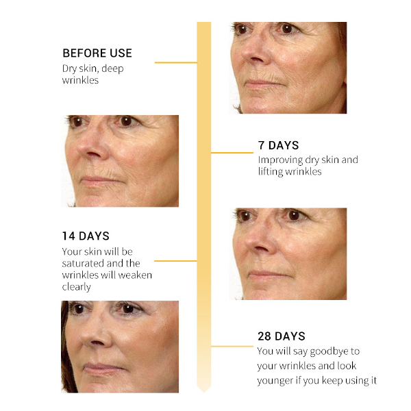 BREYLEE Retinol Anti-Aging Face Cream Firming Wrinkle Removal Day Cream Moisturizing Whitening  Skin Care