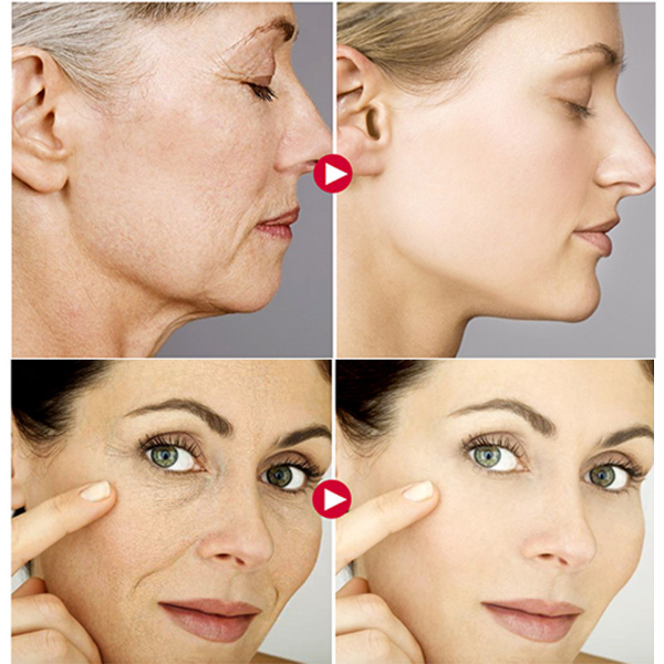 BREYLEE Retinol Anti-Aging Face Cream Firming Wrinkle Removal Day Cream Moisturizing Whitening  Skin Care