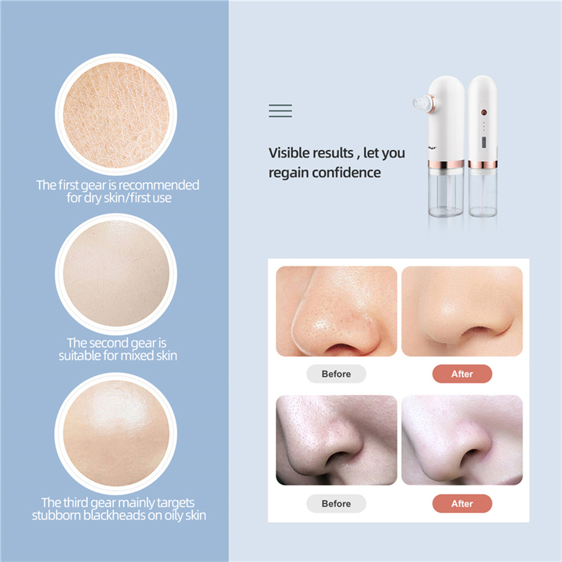 Electric Small Bubble Blackhead Remover USB Rechargeable Water Circulation Pore Acne Removal