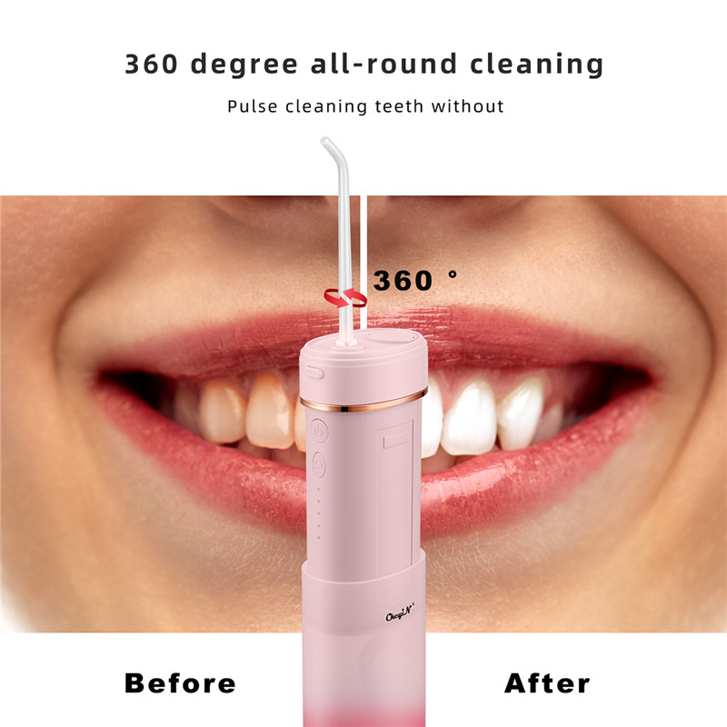 Portable Dental Flusher High-frequency Pulse Oral Irrigator Professional Water Pick Water Flosser