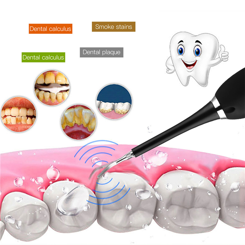 High-Frequency Vibration Toothbrush Electric Calculus Remover Teeth Whitening Stains Tartar Tool