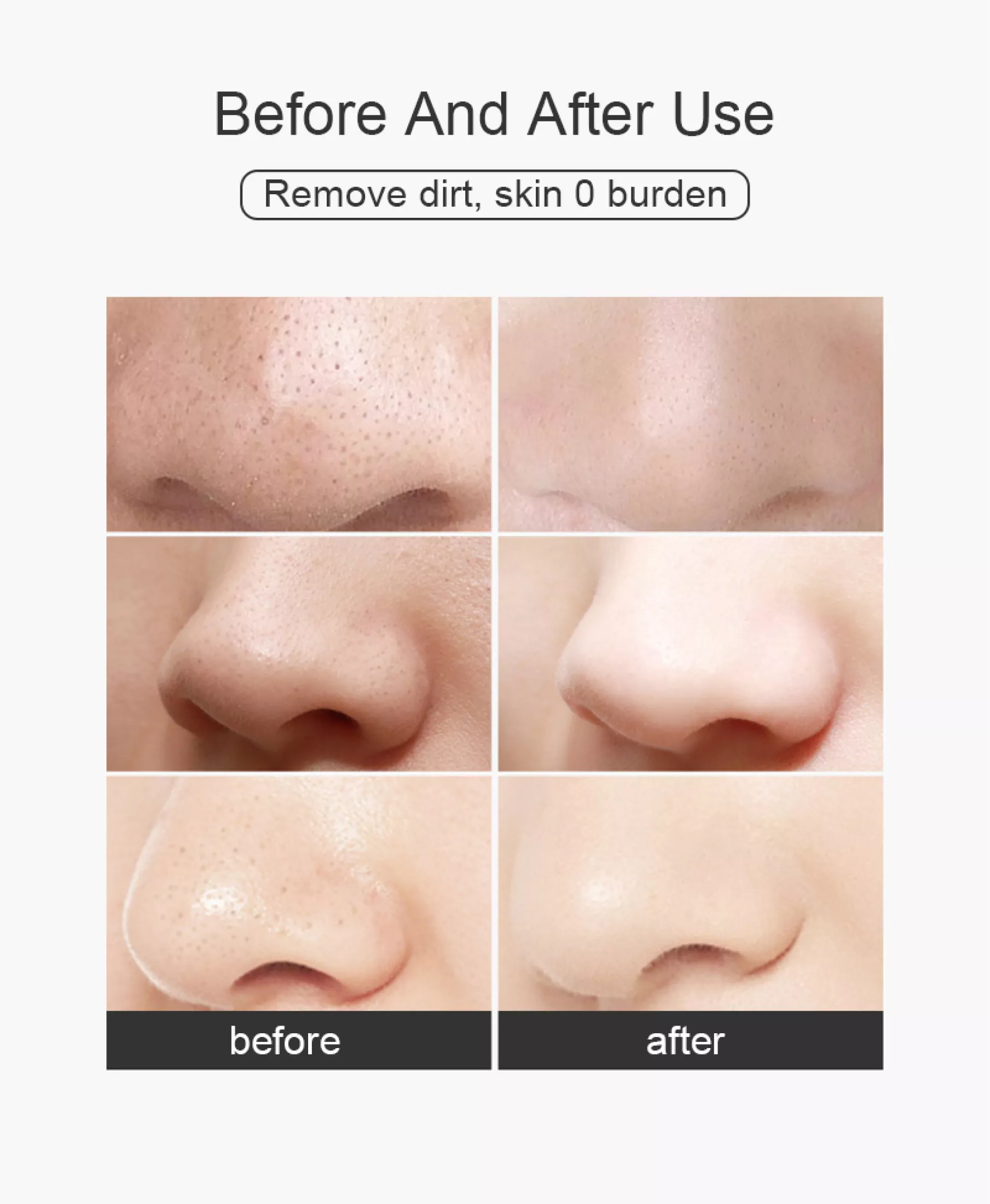 6 Suctions Electric Blackhead Remover Vacuum Pore Nose Vacuum Suction Deep Facial Cleanser Acne Extractor Pores Deeply Cleaning Tool Beauty Device