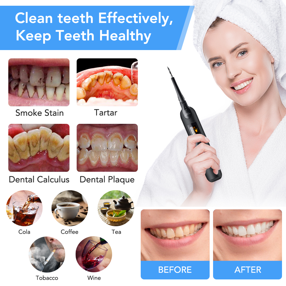 Electric Ultrasonic Dental Scaler Oral Irrigator Care Teeth Whitening Kit Teeth Calculus Tartar Remover Tool