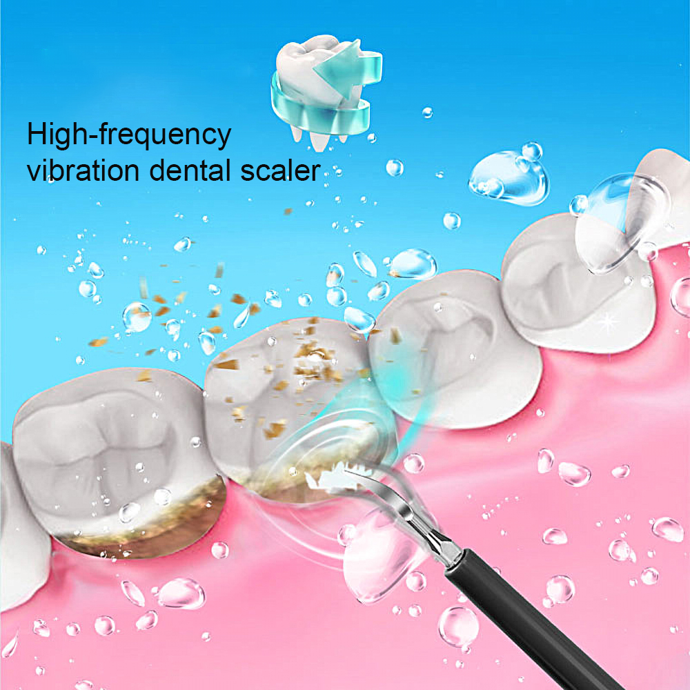 4 In 1 Electric Oral Irrigator Dental Tartar Mirror Professional Dental Calculus Remover Sonic Toothbrush Oral Stain Remover Kit