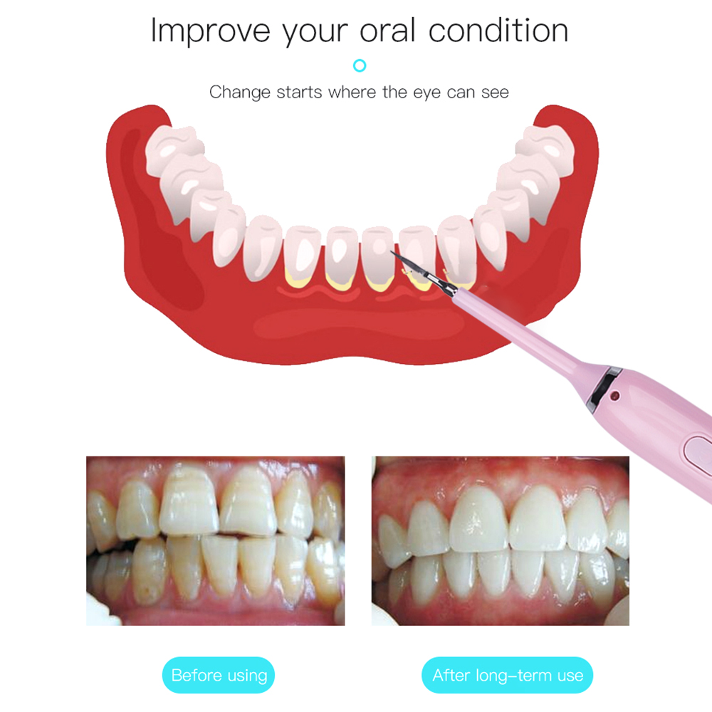 4 In 1 Electric Oral Irrigator Dental Tartar Mirror Professional Dental Calculus Remover Sonic Toothbrush Oral Stain Remover Kit