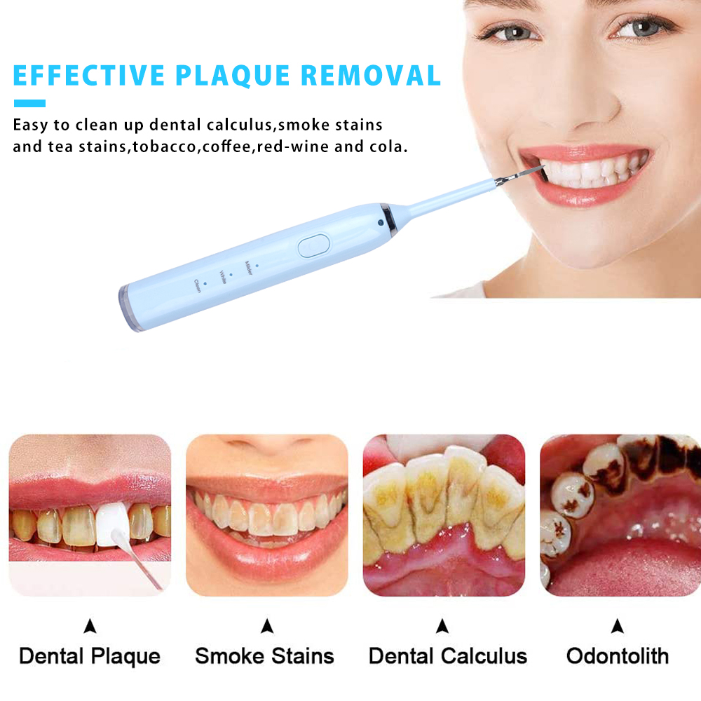 4 In 1 Electric Oral Irrigator Dental Tartar Mirror Professional Dental Calculus Remover Sonic Toothbrush Oral Stain Remover Kit
