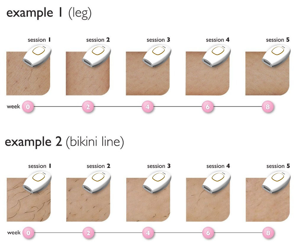 Electric Laser Epilator For Women Permanent IPL Hair Removal 600000 Flash Hair Removal Photoepilator Painless Home Use Devices