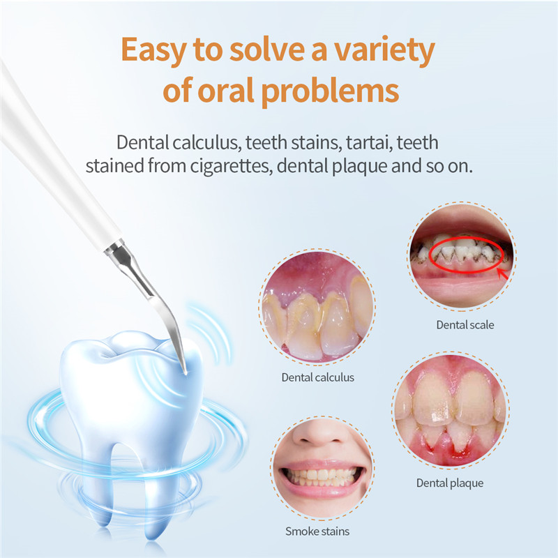 Ultrasonic Electric Dental Scaler Teeth Whitening Device Remove Dental Calculus Yellow Teeth Tartar Teeth Cleaning Oral Care