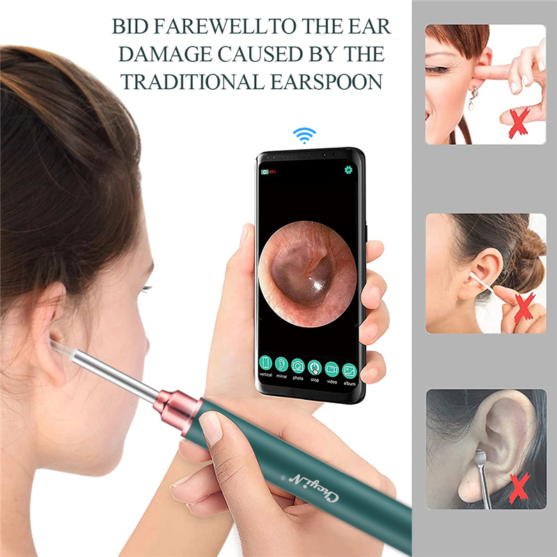 WiFi Visual Ear Pick Ear Cleaning Camera Otoscope LED Light