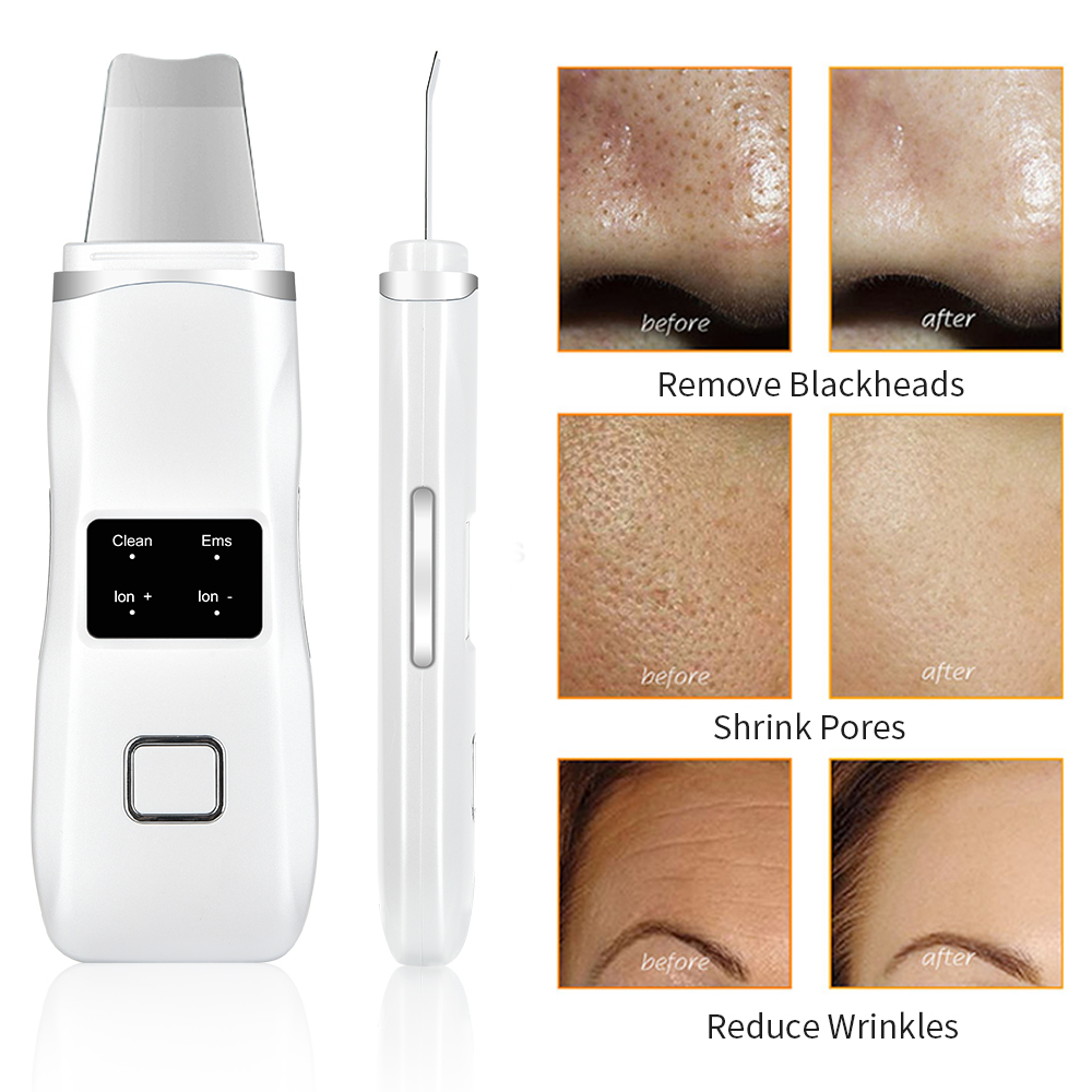 Ultrasonic Skin Scrubber LED Photon Ion Deep Face Cleaning Vibration Massager Rechargeable USB Acne Blackhead Removal Cleanser