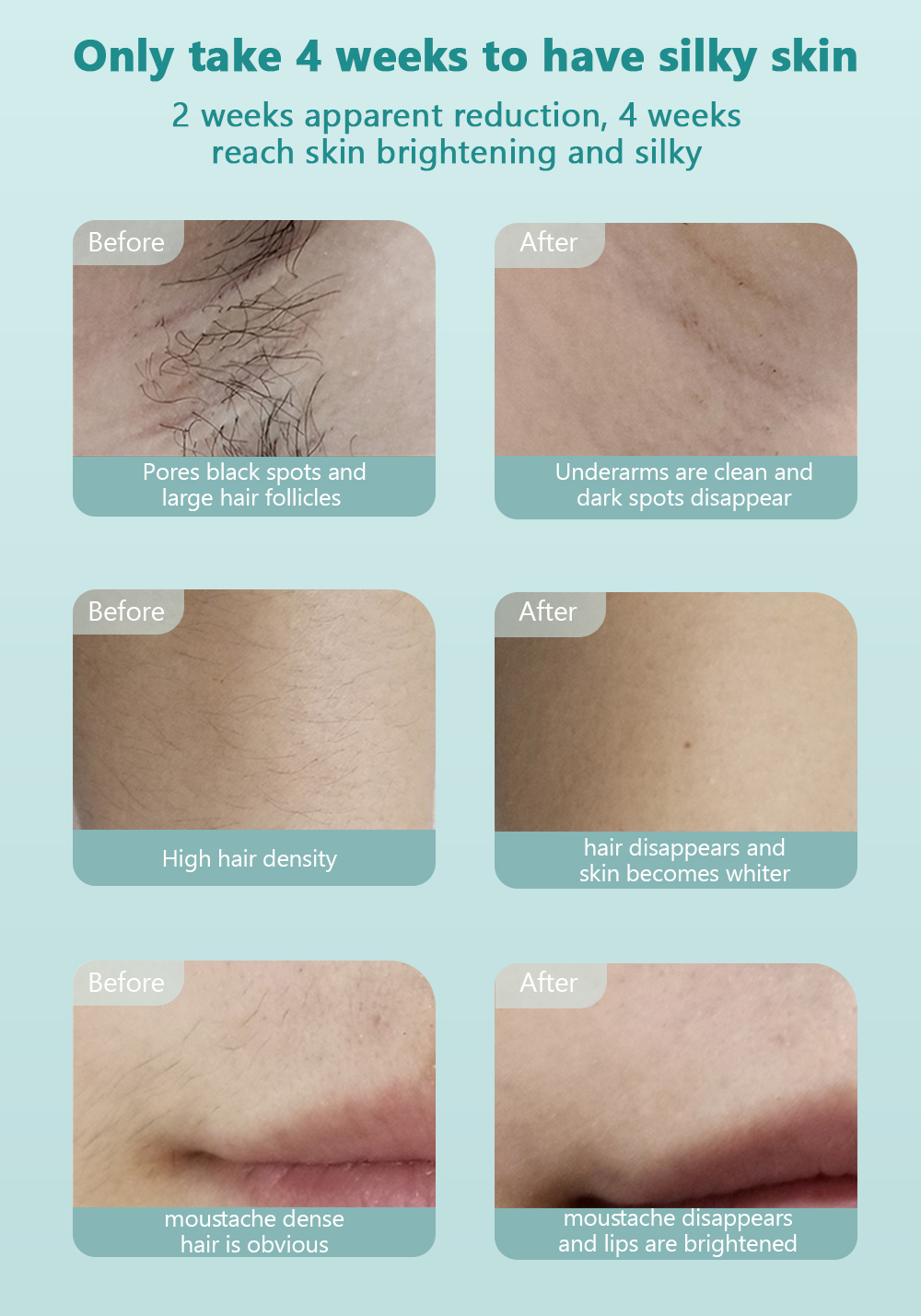 MINI Facial Epilator Face Bikini Line Laser IPL 990000 Flash Hair Removal Electric Eyebrow Trimmer Razor Painless 360 Degree Lips BodyHair Expoliator Female Male Hair Remove Machine