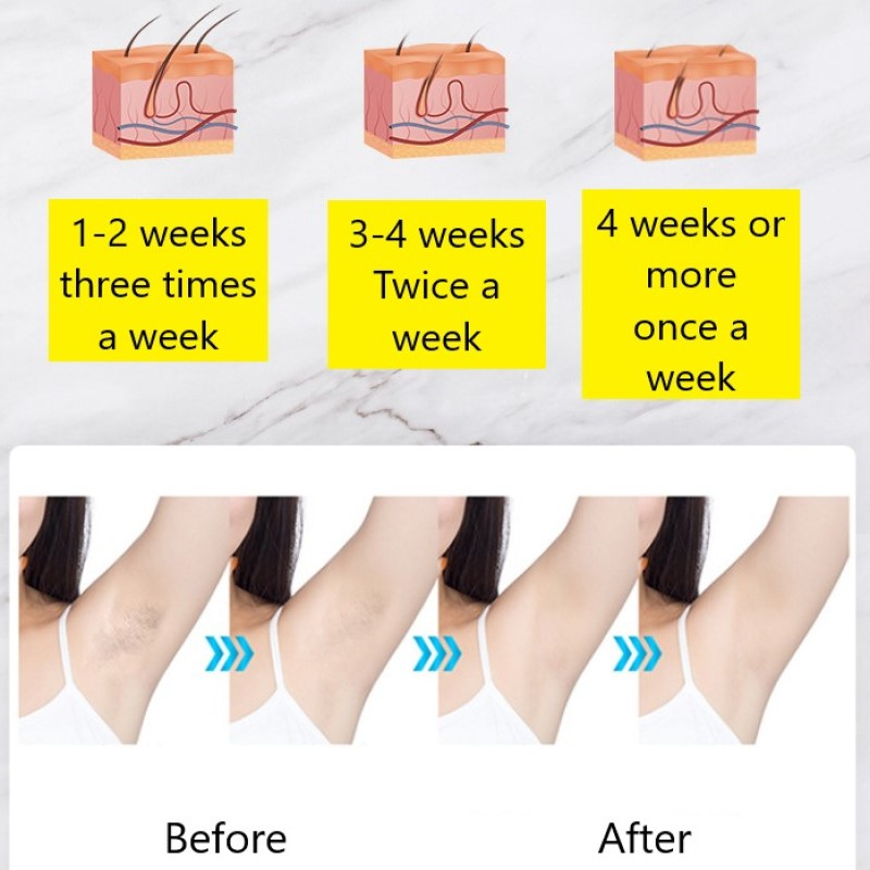 IPL Hair Removal Laser Epilator For Women Portable 990,000 Flash Permanent Painless Whole Body Photoepilator Depilador Laser