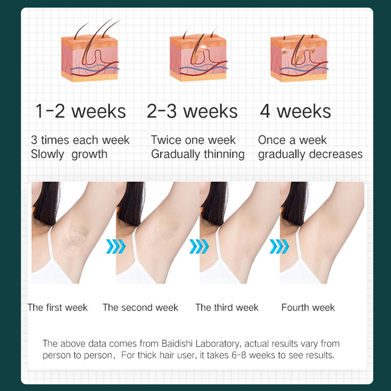 Laser Hair Removal Instrument Ladies Lip Hair Removal Electric Shaving Armpit Hair IPL Epilator Laser Epilator Facial Body Permanent Painless Epilator