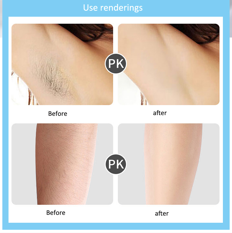 999,900 Flashes IPL Laser Hair Removal for Women and men Permanent Painless At-Home Device for Bikini Armpit Lips Leg