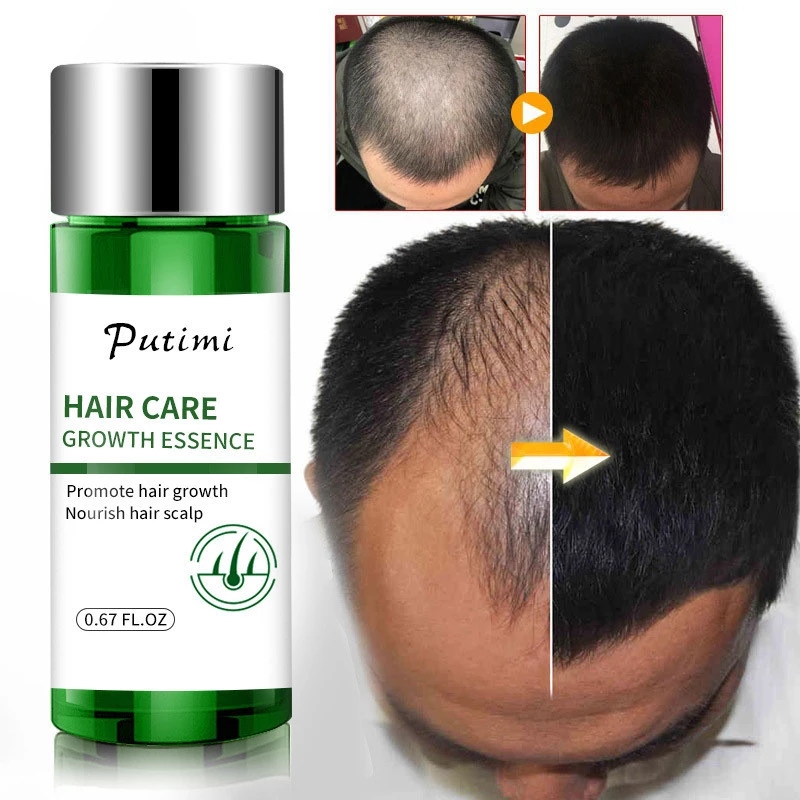Hair Growth Essential Oil Promoting Hair Growth Prevent Baldness Scalp Anti Hair Loss for Men Women