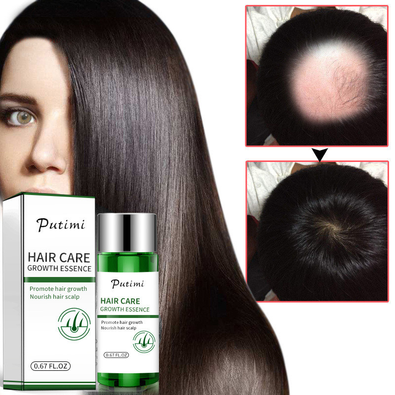 Hair Growth Essential Oil Promoting Hair Growth Prevent Baldness Scalp Anti Hair Loss for Men Women